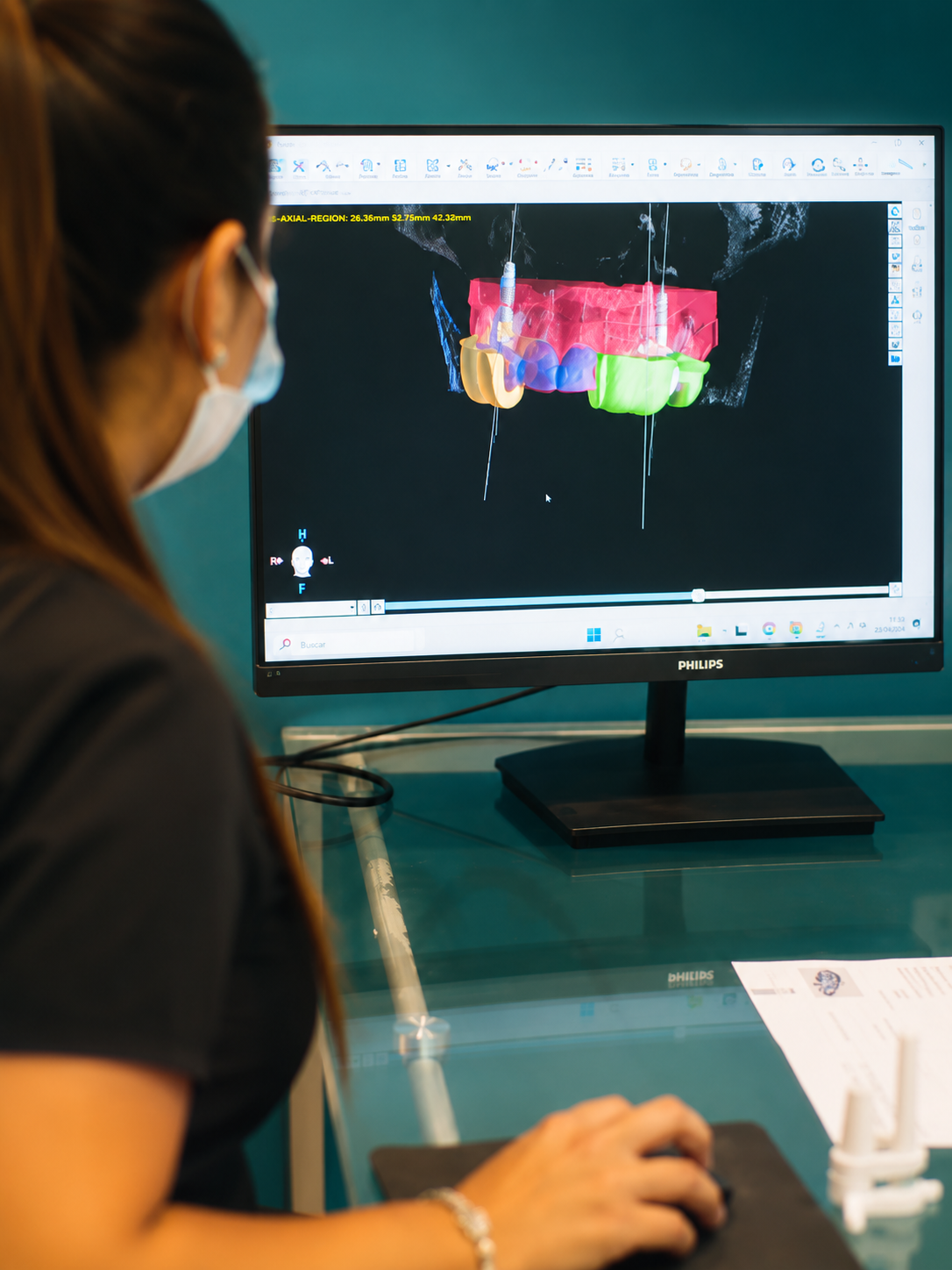 Pantalla con diseño digital de sonrisa CAD/CAM